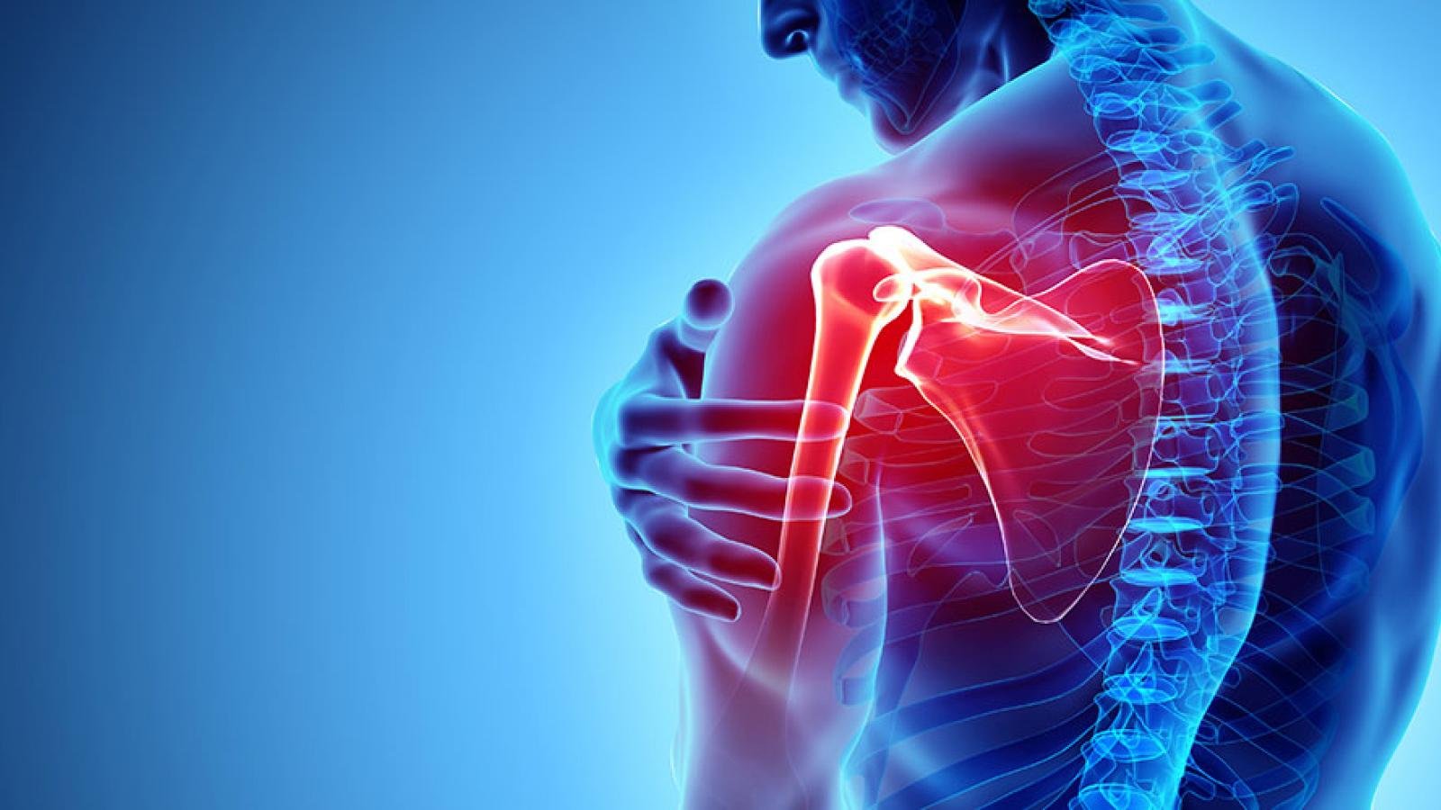 Illustration related to shoulder health